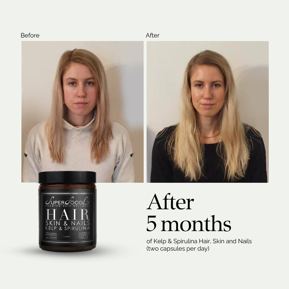 
                      
                        HAIR, SKIN AND NAILS SUPPLEMENT x2
                      
                    