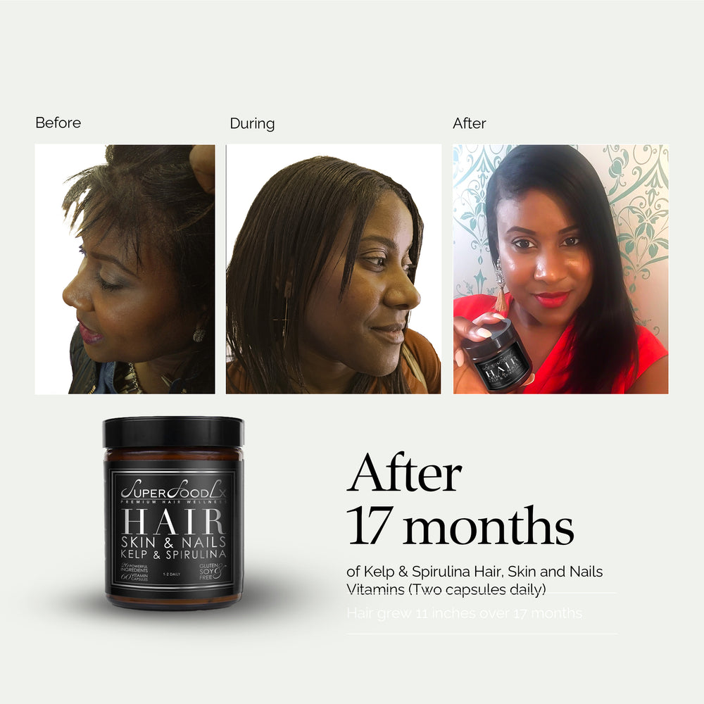 
                      
                        HAIR, SKIN AND NAILS SUPPLEMENT x3
                      
                    