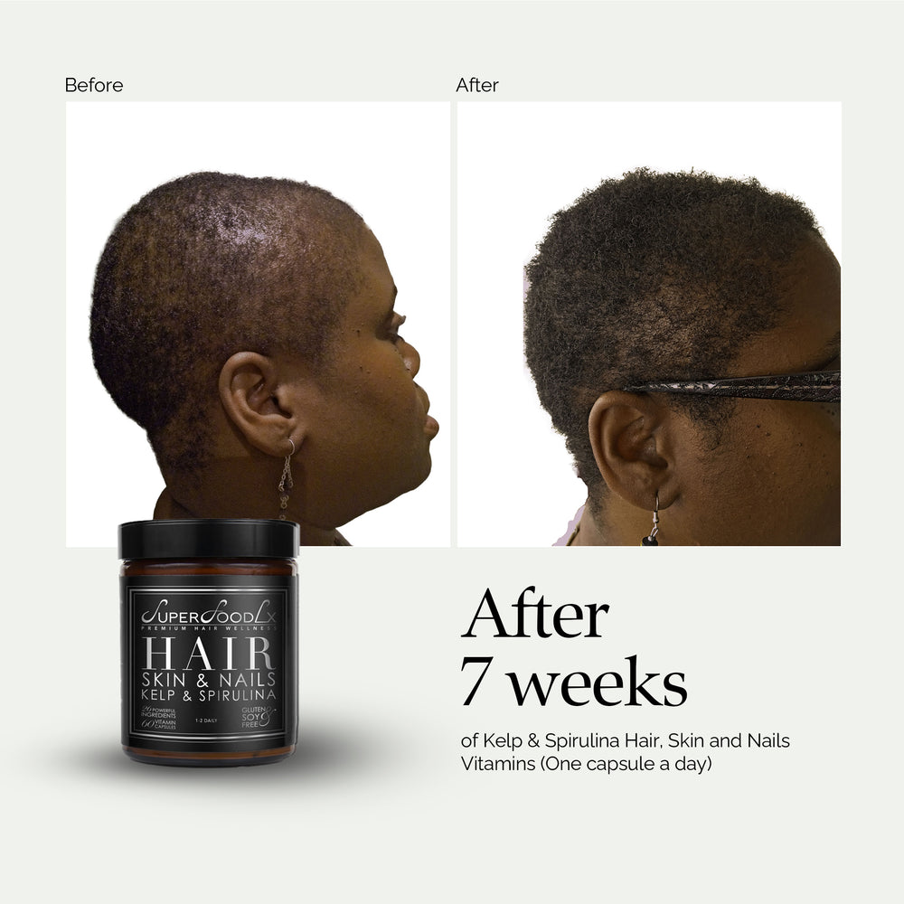 
                      
                        HAIR, SKIN AND NAILS SUPPLEMENT x2
                      
                    