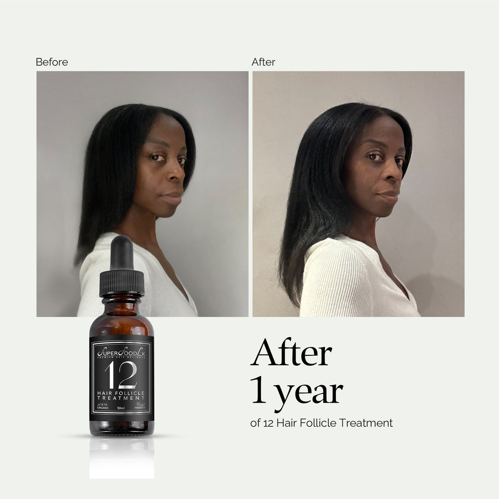 
                      
                        12 HAIR FOLLICLE TREATMENT
                      
                    