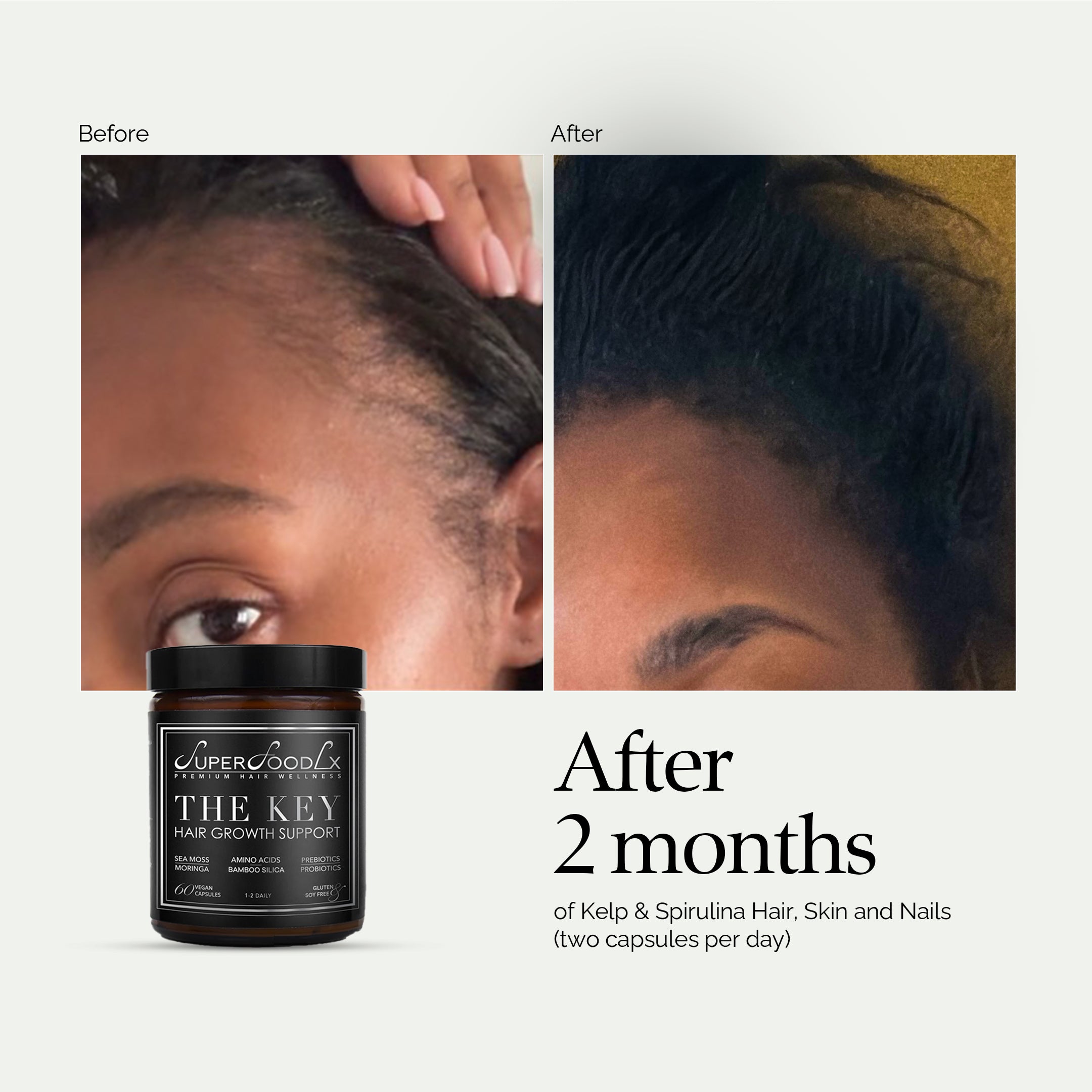 The Key Seamoss Hair Growth Supplements Products – SuperFoodLx